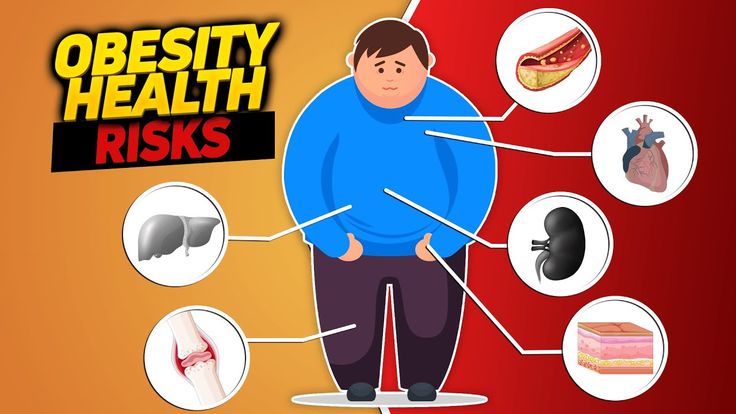 Obesitas