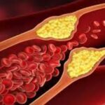 8 Jenis Makanan Penurun Kolesterol