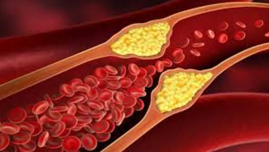 8 Jenis Makanan Penurun Kolesterol